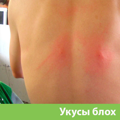 Укусы блох в Белорецке