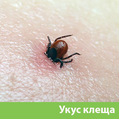 Укус клеща в Белорецке